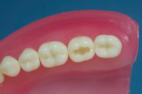 Dente Para Manequim De Dentística 47