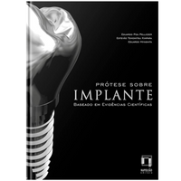Livro Prótese Sobre Implante - Baseado em Evidências Científicas