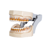 Manequim para Periodontia com Doenças Periodontais