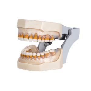 Manequim para Periodontia com Doenças Periodontais