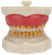 Manequim Periodontia Modelo FG Orais - Ref. 289