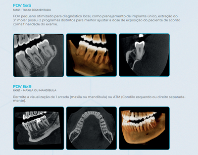 Panorâmico e Tomógrafo 3D Eagle Edge – Linha Pro (SFOV) - DABI ATLANTE -  Sou Odonto