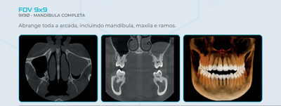 Panorâmico e Tomógrafo 3D Eagle Edge – Linha Pro (SFOV) - DABI ATLANTE -  Sou Odonto