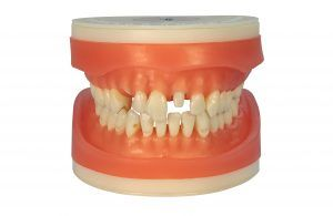 Refil Materiais Dentários AC100
