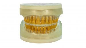 Refil Periodontia I AC104 