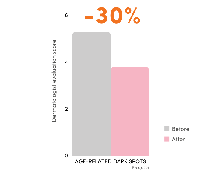 nutricosmetic ingredient age related dark spots