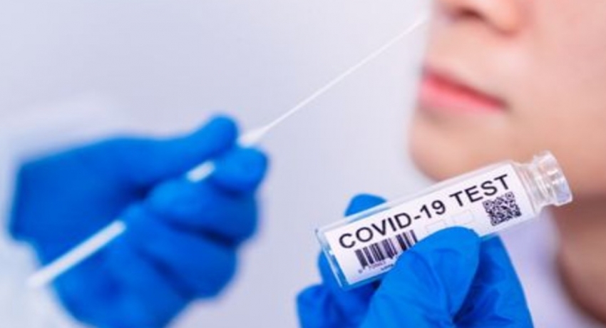 கொழும்பில் எழுமாறான PCR பரிசோதனைகள் அதிகரிப்பு