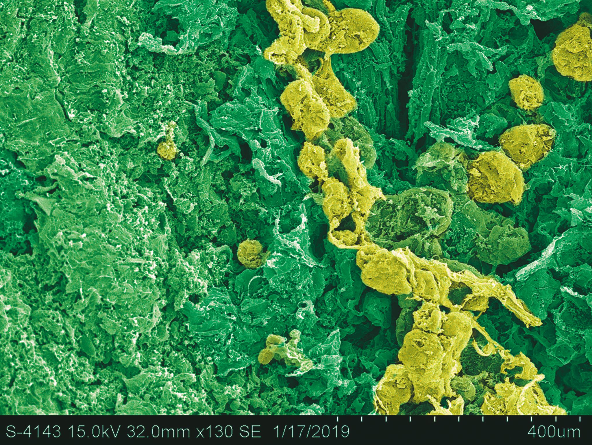 Fermentation as Metaphor‘Doubanjang (Sichuan-style fermentation of broad beans with chilis) with scanning electron microscope.’ Copyright 2019 by MIMIC. Used by permission.