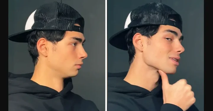 What Is Mewing? Let's Find Out Here So You Don't Get Confused!