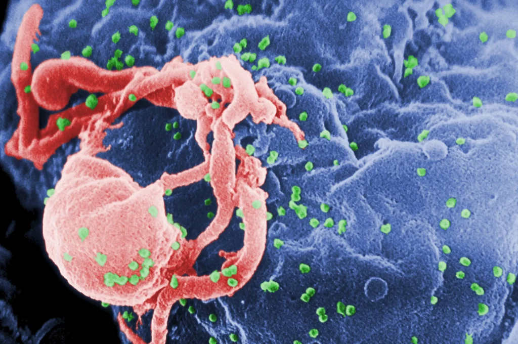 An electron micrograph showing HIV 1 budding from cultivated lymphocytes in green