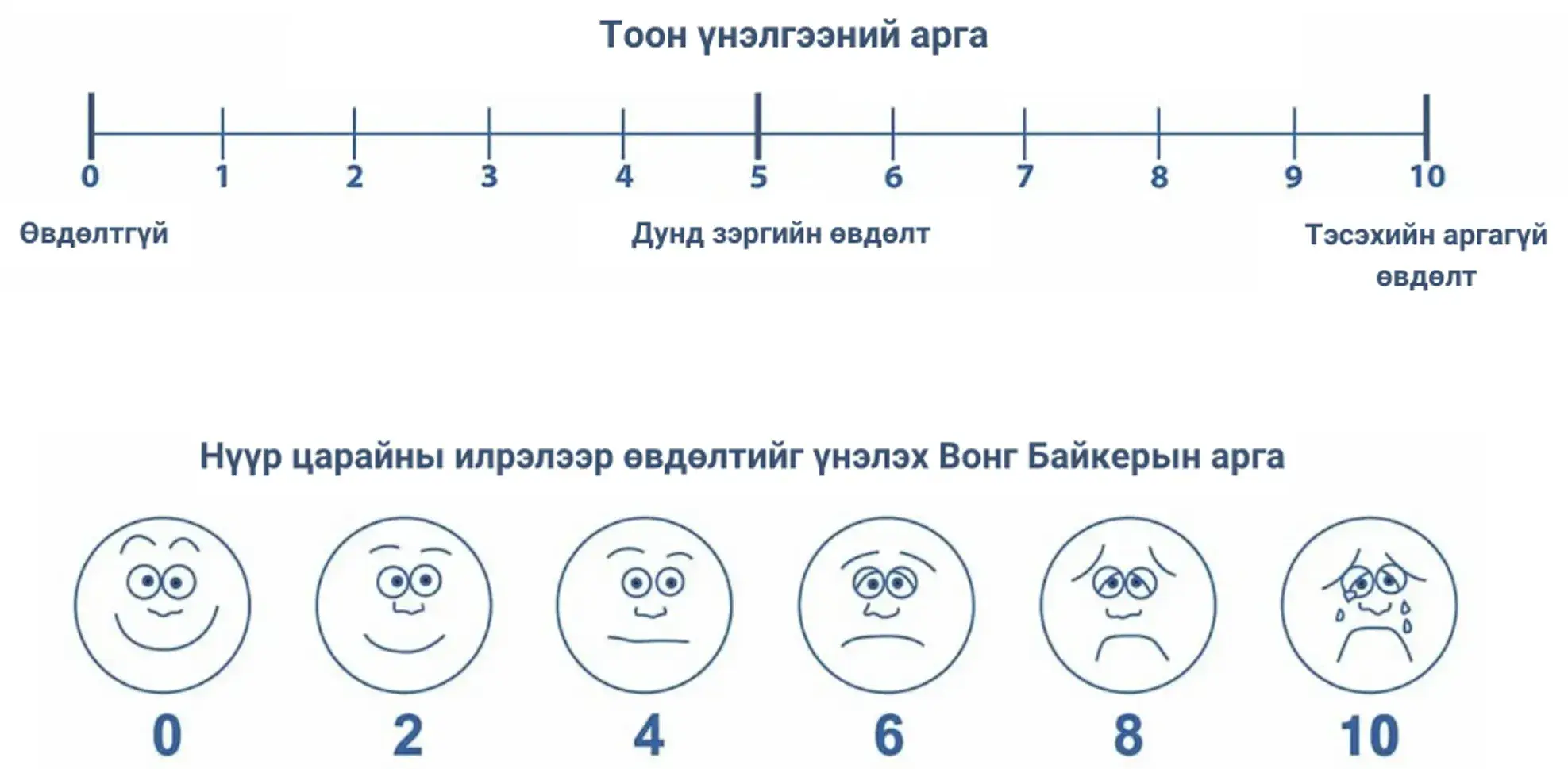 Өвдөлтийн менежментийг тоймлох нь