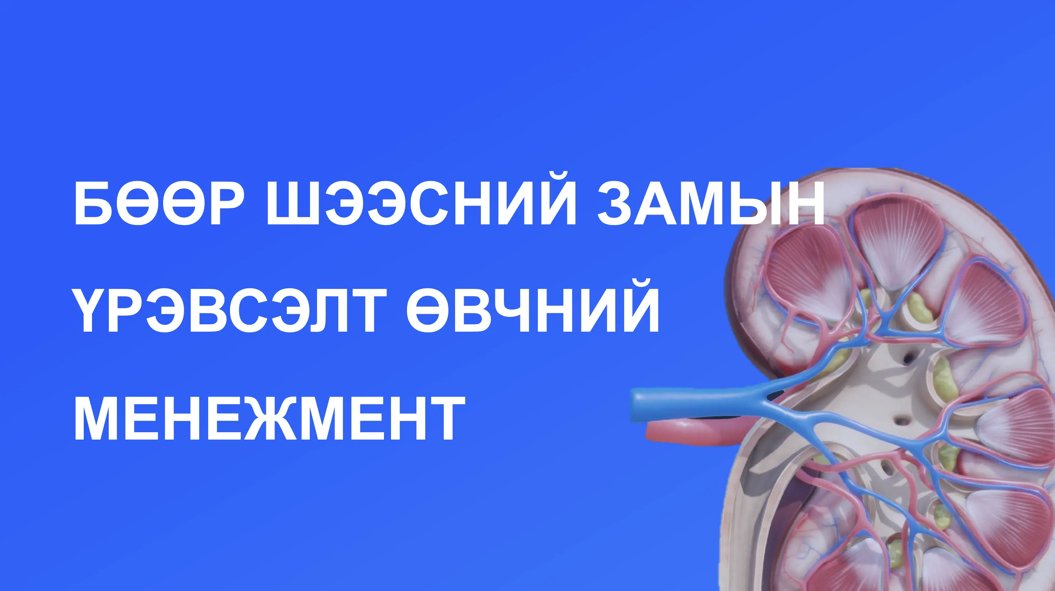 Бөөр, шээсний замын үрэвсэлт өвчний менежмент сургалт