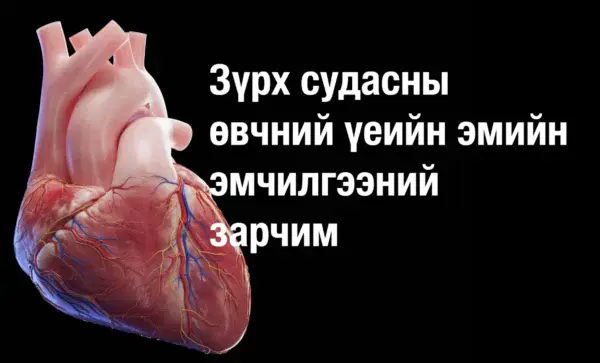 Зүрх судасны өвчний үеийн эмийн эмчилгээний зарчим