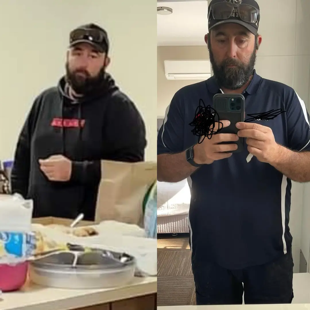 B&A 1 - Anthony 21.webp