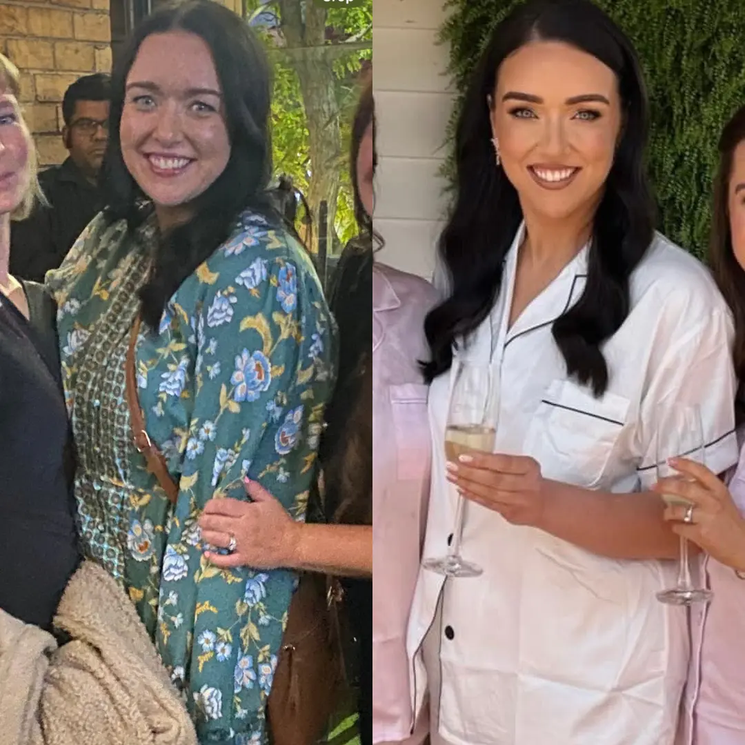 lauren-B&A side by side.webp