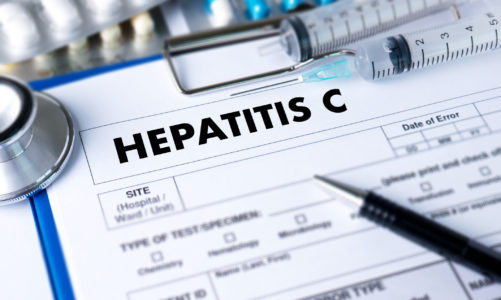 What People Need to Know About Hep C
