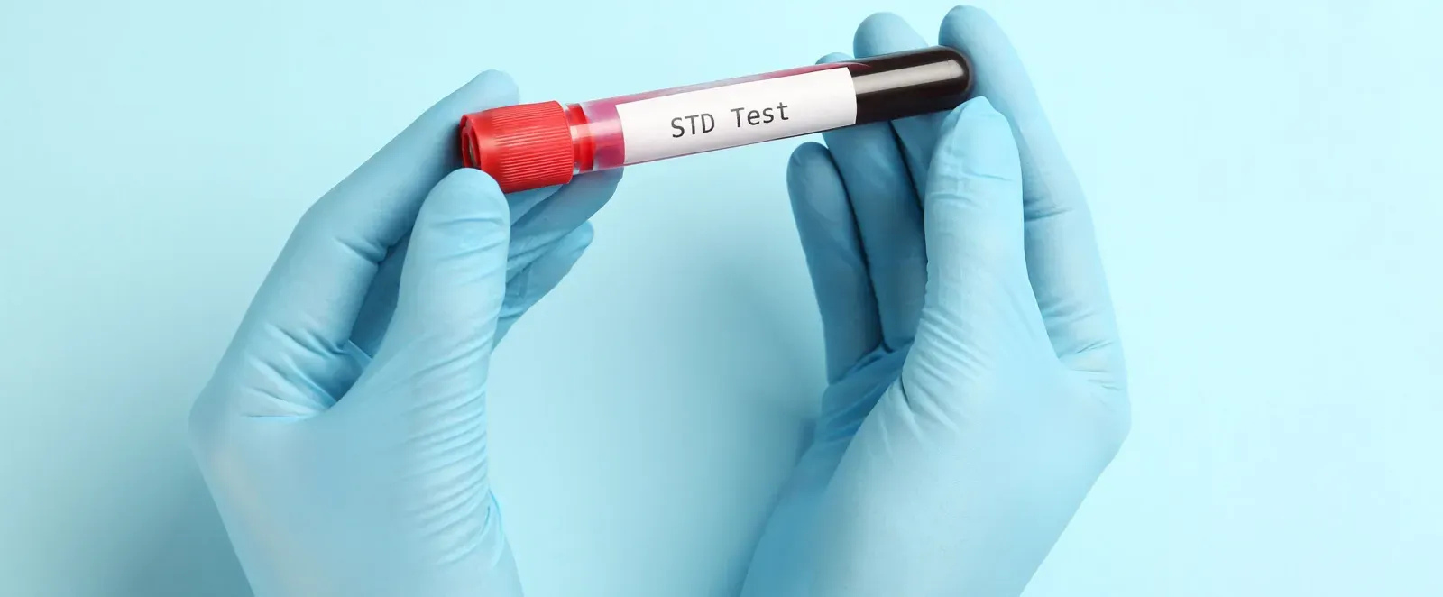 Emergency STD Testing