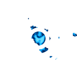 Density fingerprint of Wad Medani