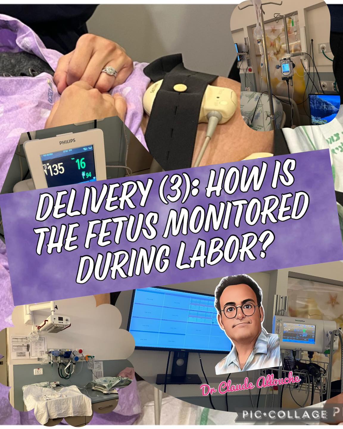 DELIVERY (3): HOW IS THE FETUS MONITORED DURING LABOR?