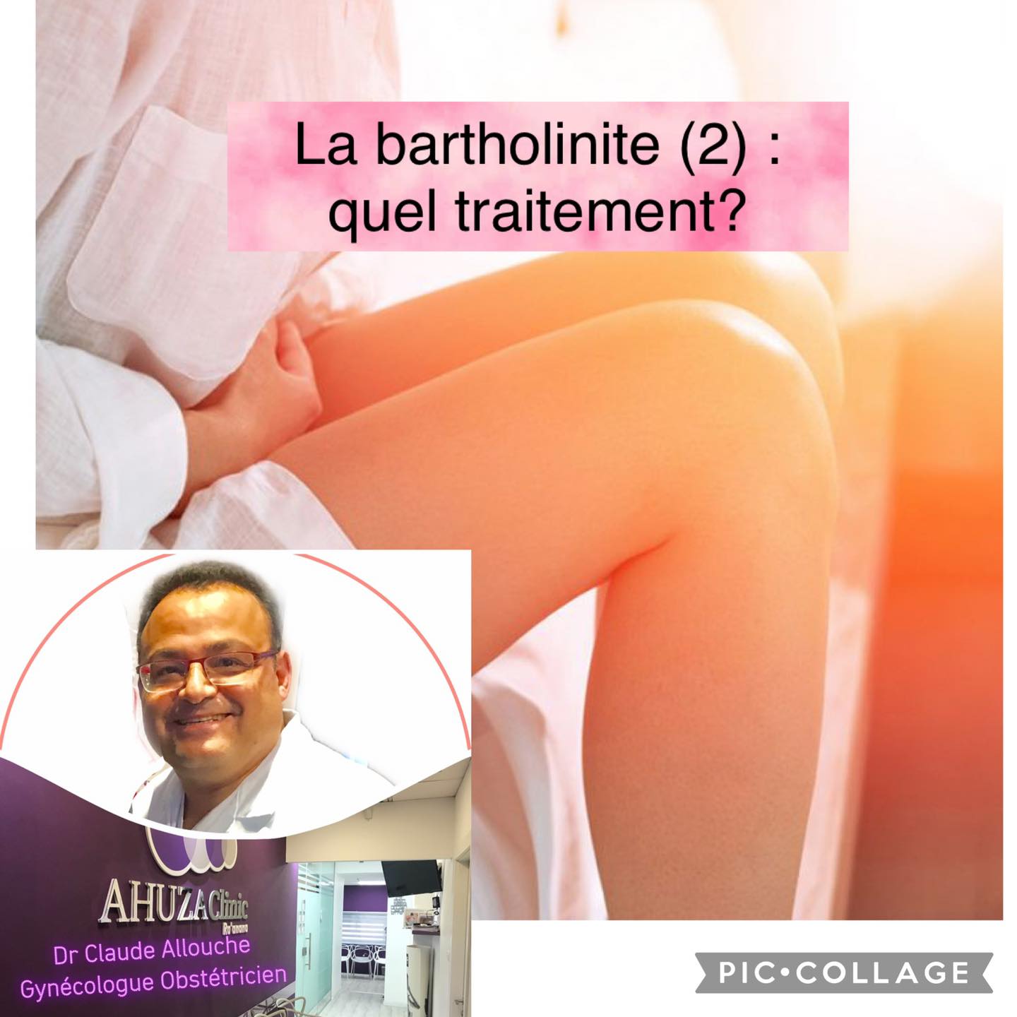 BARTHOLINITE (2) : QUEL TRAITEMENT?