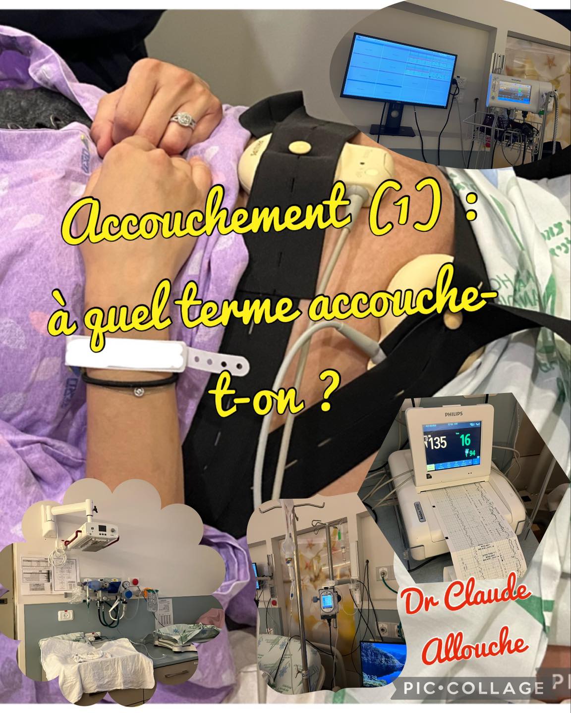 ACCOUCHEMENT (1) : A QUEL TERME ACCOUCHE T’ON?