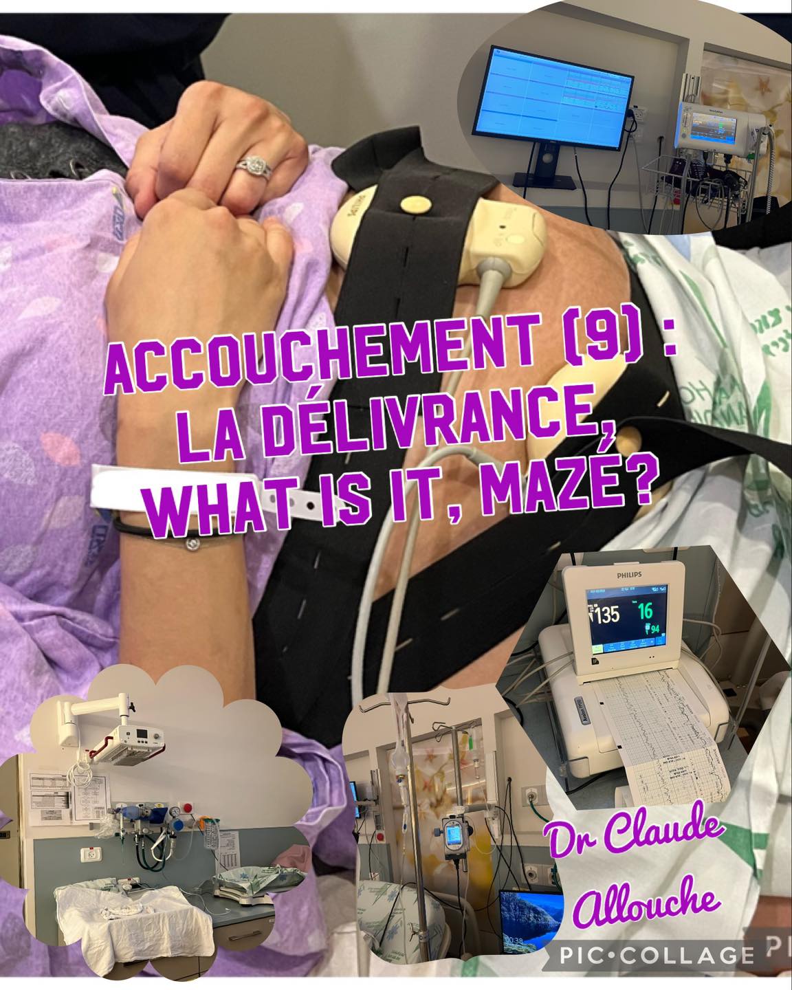 ACCOUCHEMENT (9) : LA DELIVRANCE : WHAT IS IT? MAZ&Eacute;?