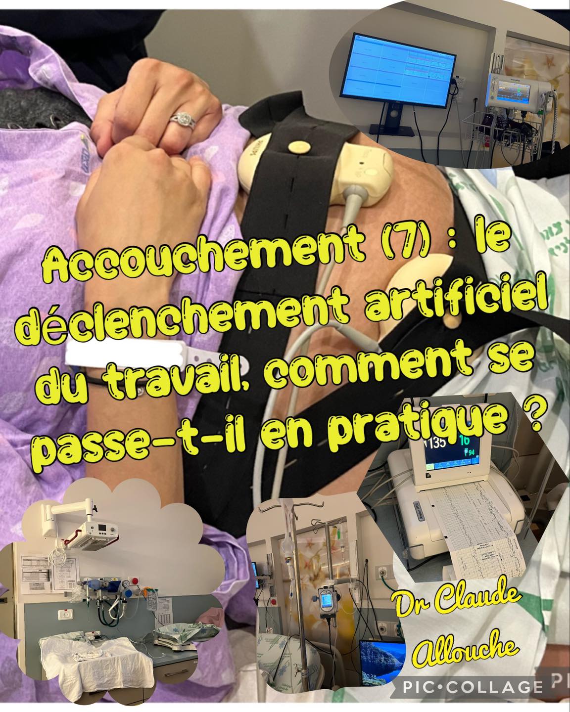 ACCOUCHEMENT (7): LE D&Eacute;CLENCHEMENT ARTIFICIEL DU TRAVAIL, COMMENT SE PASSE T&rsquo;IL EN PRATIQUE?