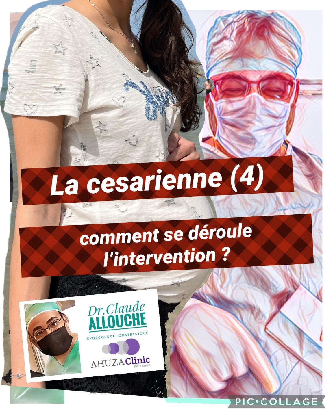 CESARIENNE (4): COMMENT SE DEROULE L&rsquo;INTERVENTION?