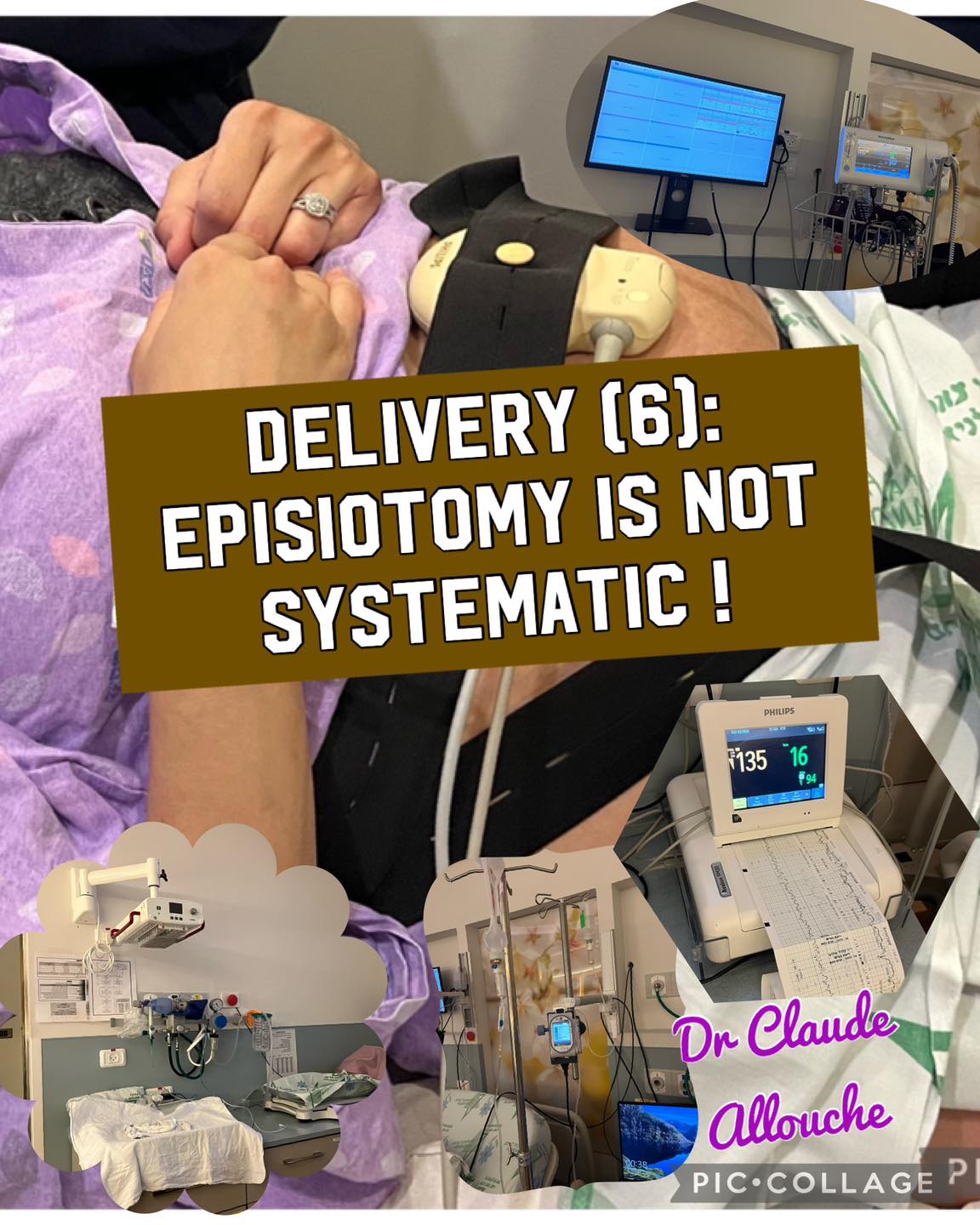 DELIVERY (6): EPISIOTOMY IS NOT SYSTEMATIC!