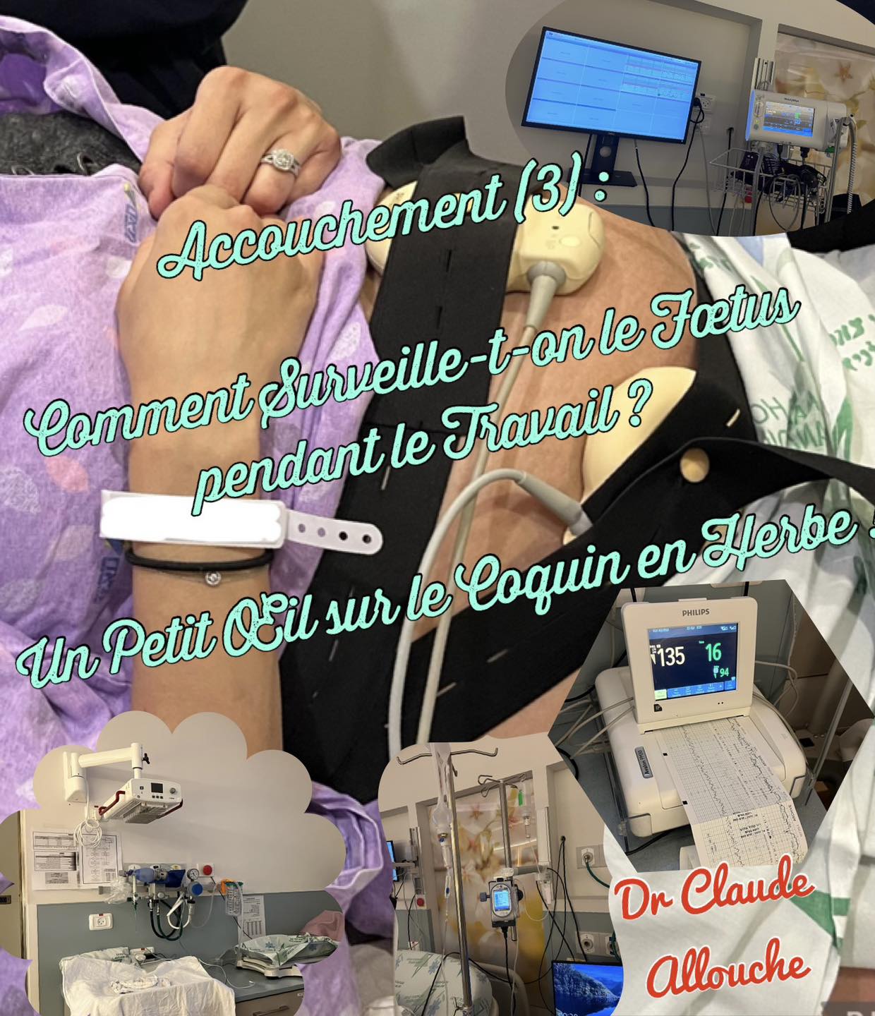 Accouchement (3) : Comment Surveille-t-on le Fœtus pendant le Travail ? Un Petit Œil sur le Coquin en Herbe !