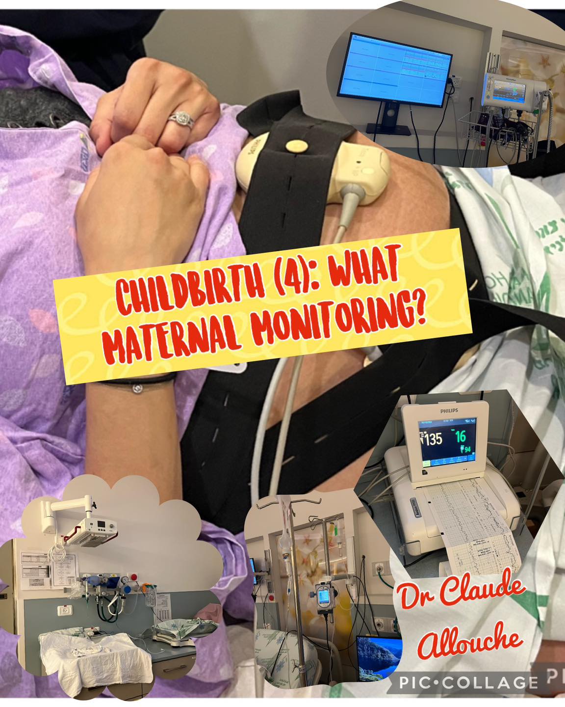 CHILDBIRTH (4): WHAT MATERNAL MONITORING?