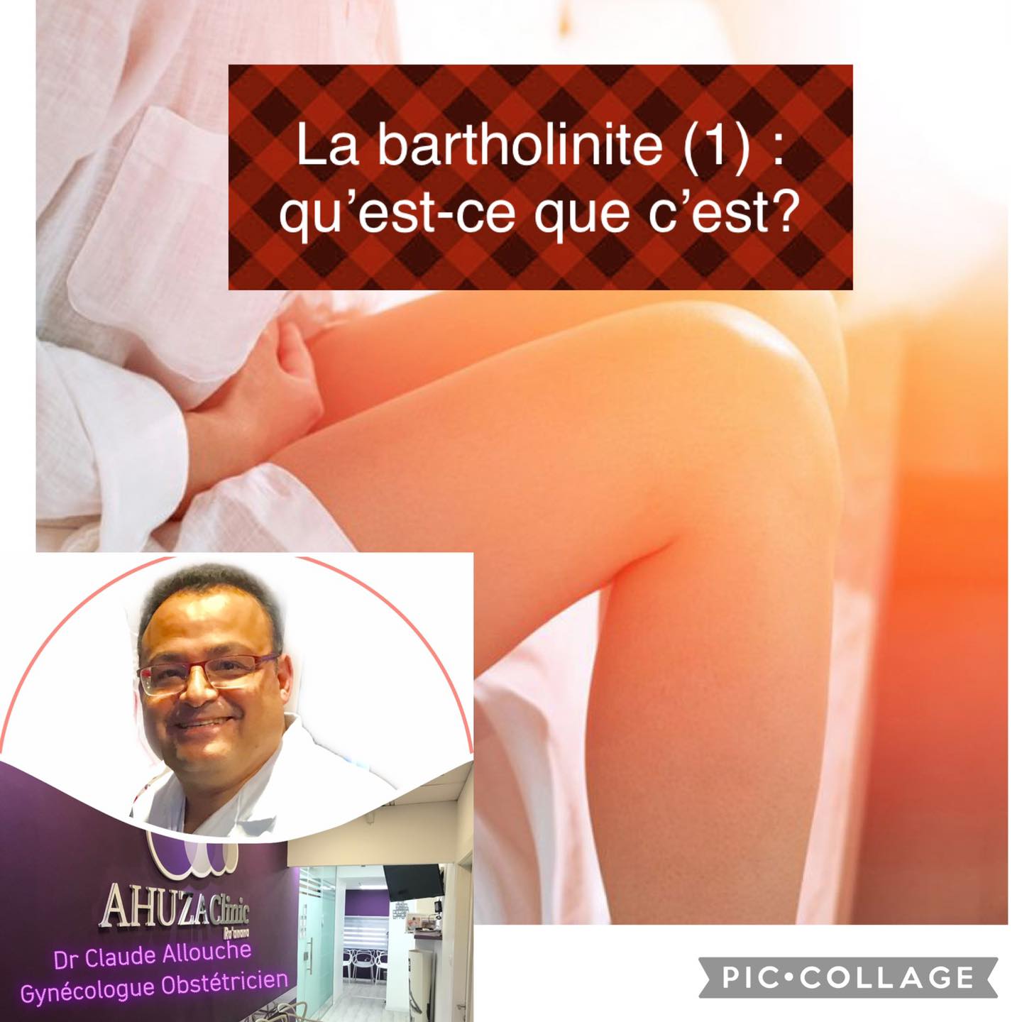 BARTHOLINITE (1) : QU’EST CE QUE C’EST?