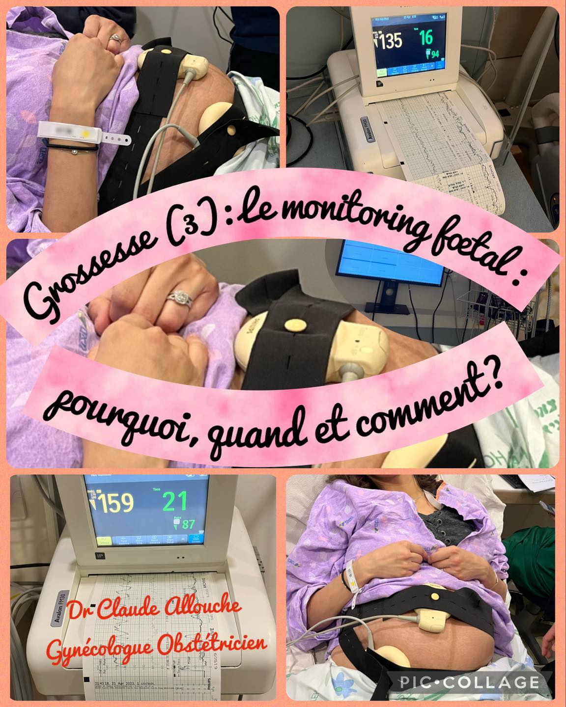 GROSSESSE (3) : LE MONITORING FOETAL, POURQUOI, QUAND ET COMMENT?