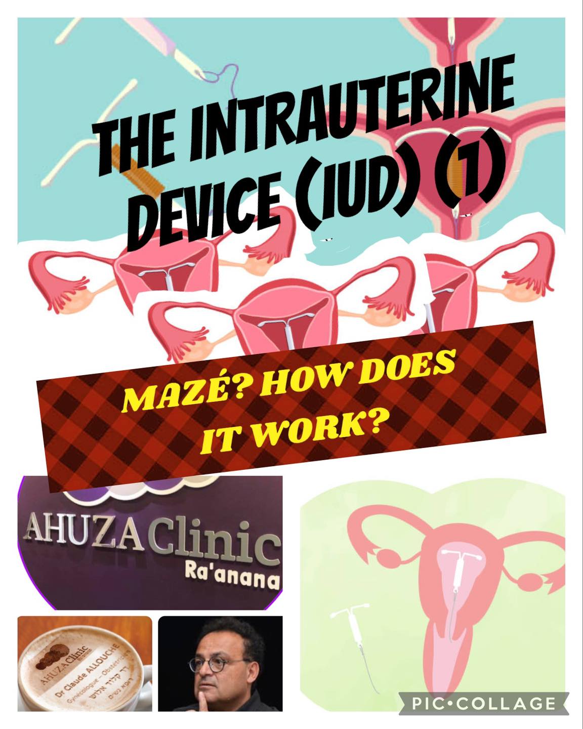 THE INTRAUTERINE DEVICE (IUD): MAZÉ? HOW DOES IT WORK?Dr. Claude Allouche, gynecologistAhuza Clinic, Raanana, Israel058 726 02 64