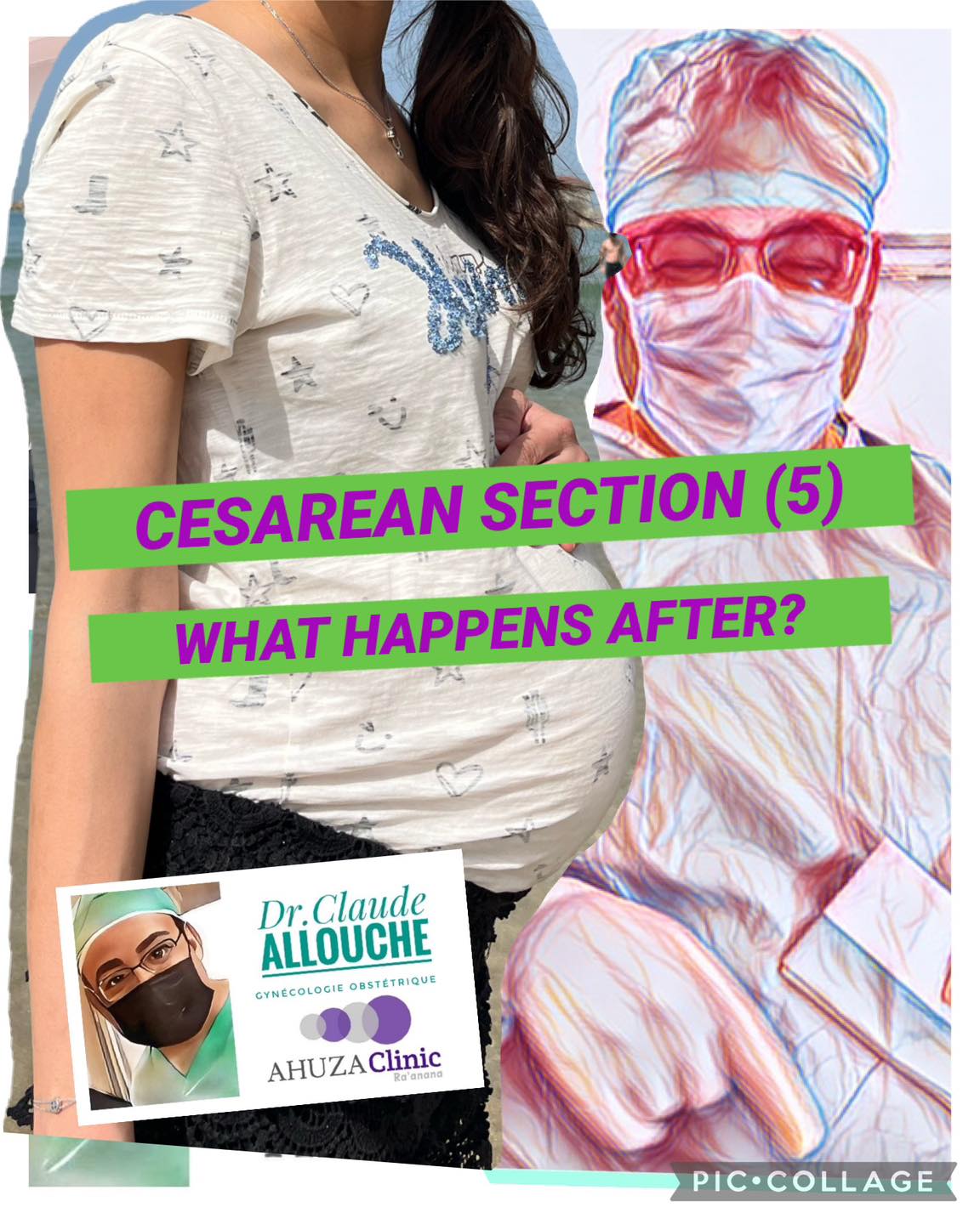CESAREAN SECTION (5): WHAT HAPPENS AFTER?