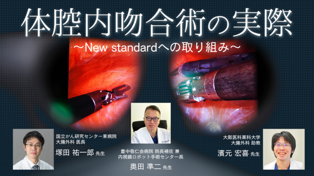 体腔内吻合術の実際 -New standardへの取り組み-