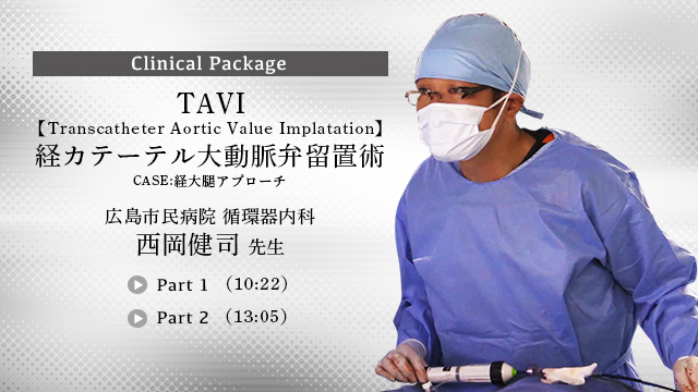 TAVI経カテーテル大動脈弁留置術 ～CASE；経大腿アプローチ