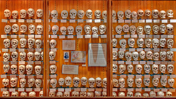 Hyrtl Skull Collection