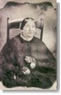 Jane Todd Crawford, the first patient to undergo an ovariectomy 