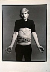 Warhol's gunshot scars