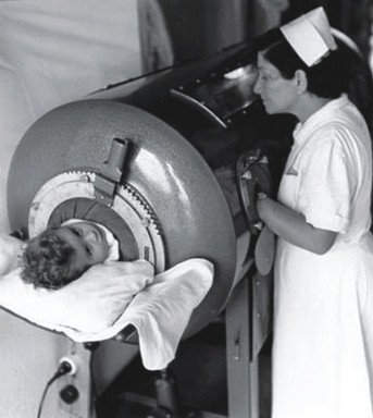 The iron lung was a critical crucial to the care of polio patients. Morris Memorial Hospital had back-up generators and hand pumps to continue to aid the patients' respiration in the event of a power outage. 