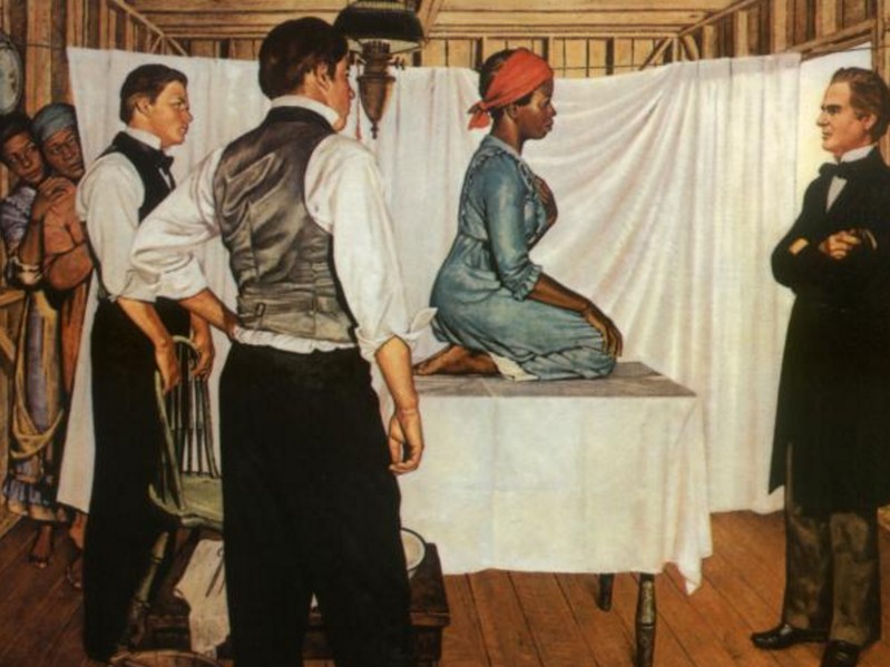 Painting by Robert Thom.  The woman on the table is Dr Sims’s patient Anarcha who received 30 operations over Sims’s 4 years of fistula experimentation. Dr Sims is the man in front of Anarcha, and the other two men are other doctors observing the procedure. The two women in the background are other enslaved experimental subjects. 