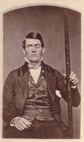 This is a photo of Phineas Gage.