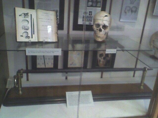 This is a photo of Gage's exhibit at Harvard University School of Medicine.