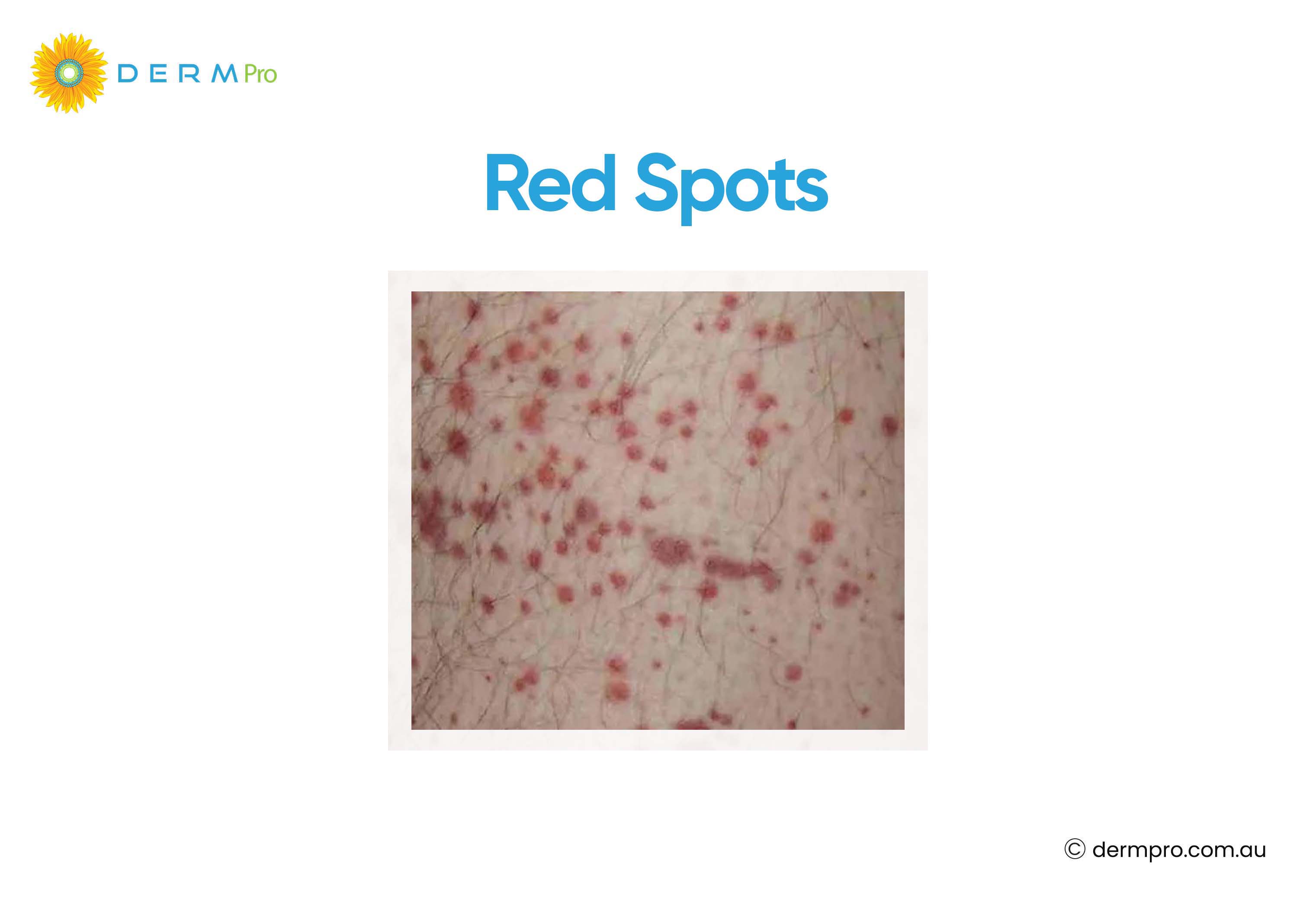 image of red spots