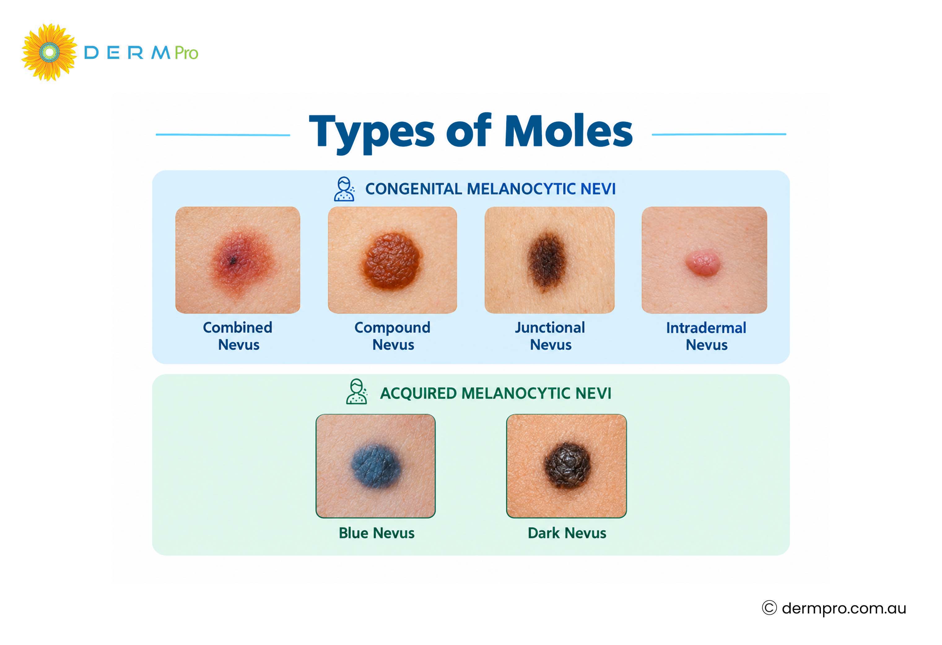 what is a mole?