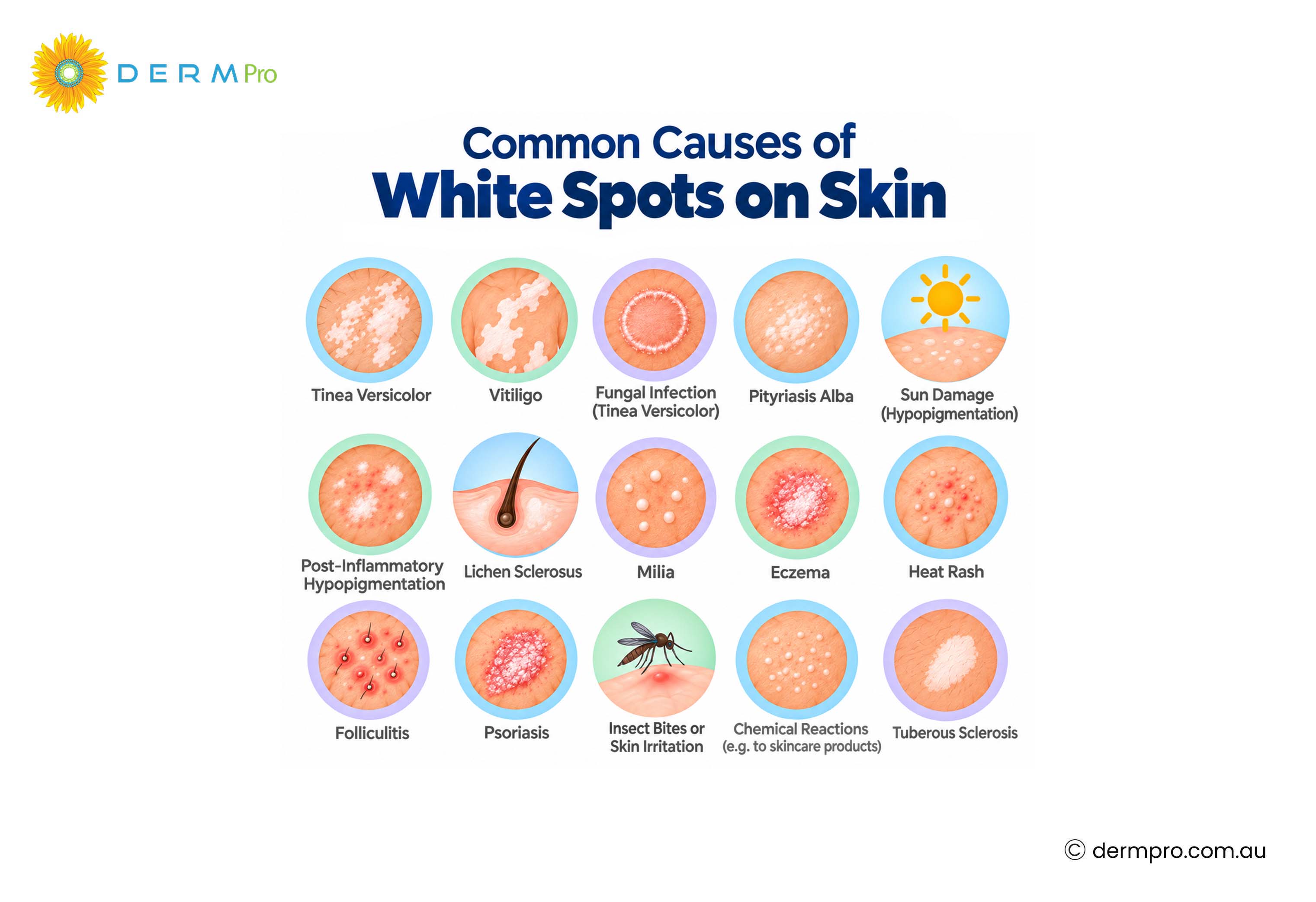 common causes of white spots on skin 