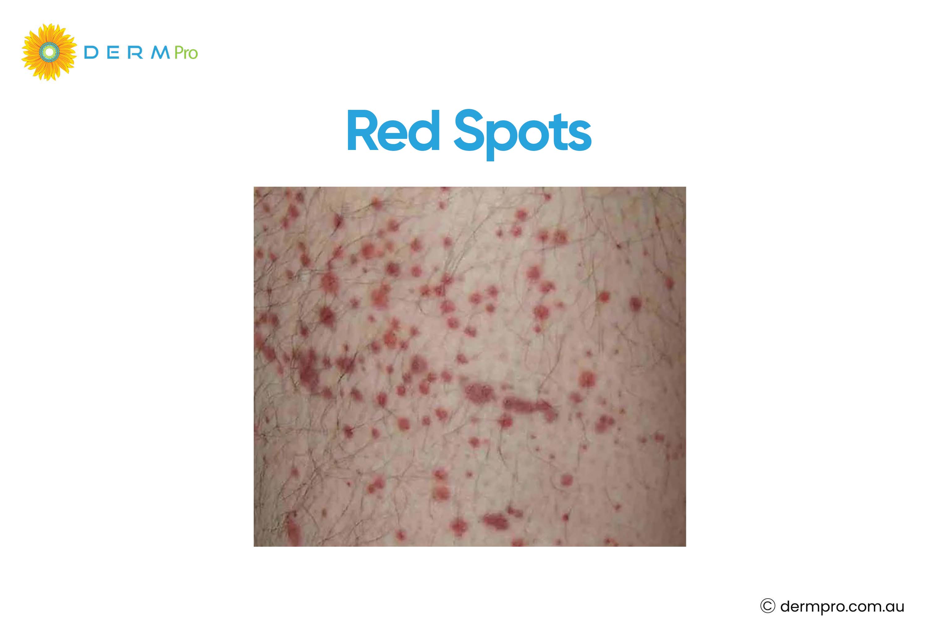 Image of red spots 