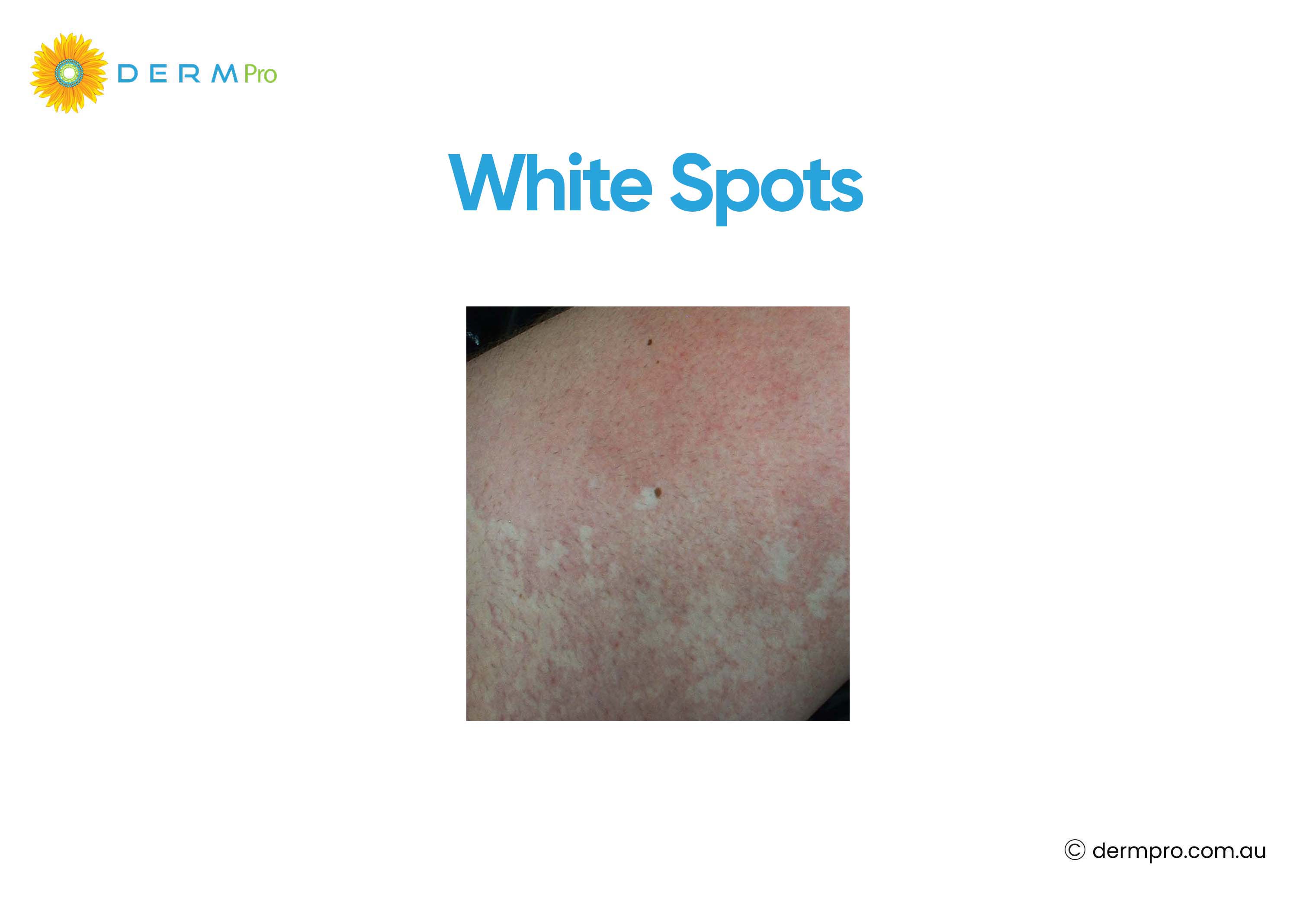 white spots image