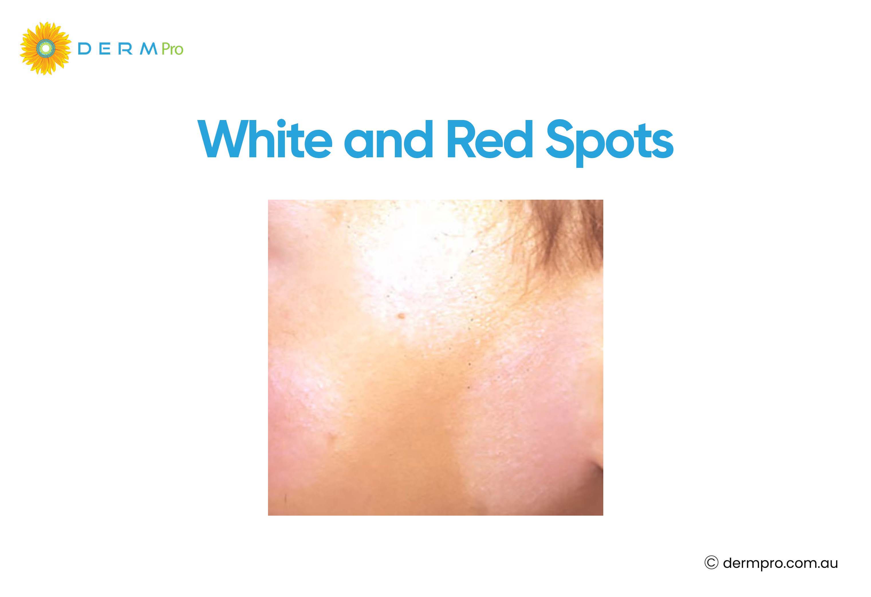 white and red spots